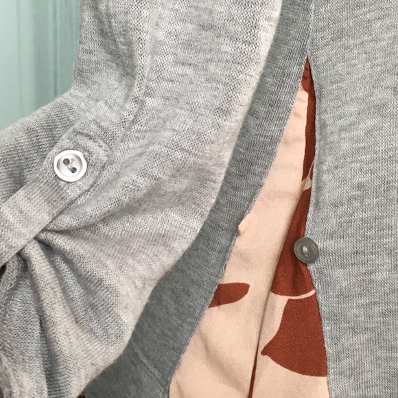 Little Yellow Button for Anthro Peplum Tunic XS - Picture 5 of 13